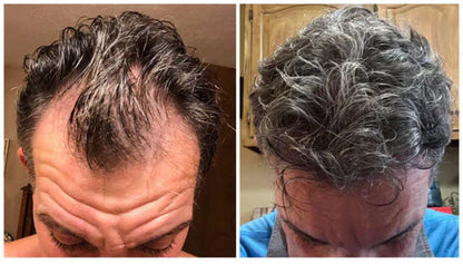Newyuo™ hair cream 18ml - Instant density effect