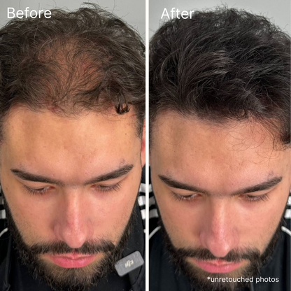 Newyuo™ hair cream 18ml - Instant density effect